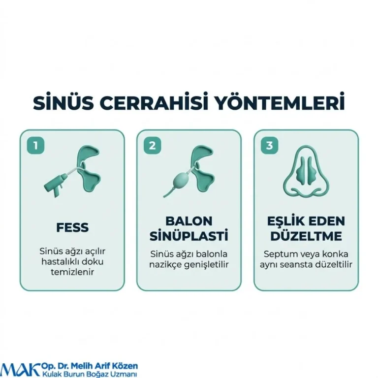 Alsancak Endoskopik Sinus Cerrahisi fiyat