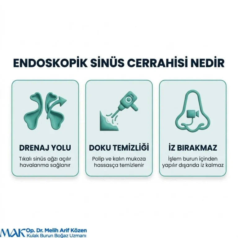 Alsancak Endoskopik sinus cerrahisi ne demek