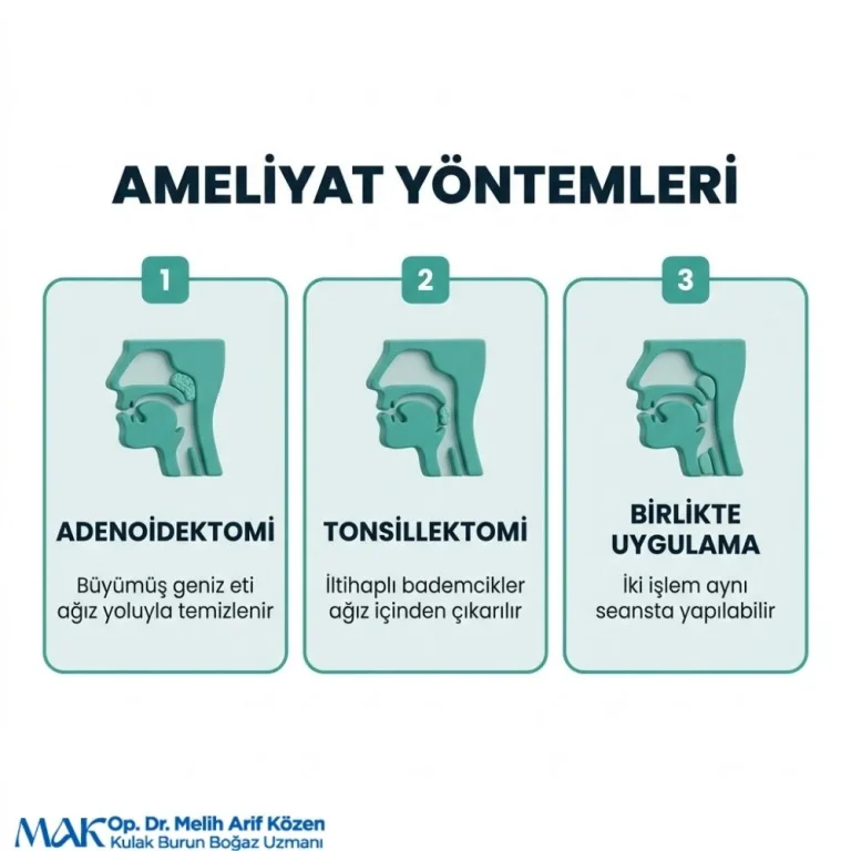 Alsancak Geniz eti ve bademcik Ameliyatı Sonrası beslenme