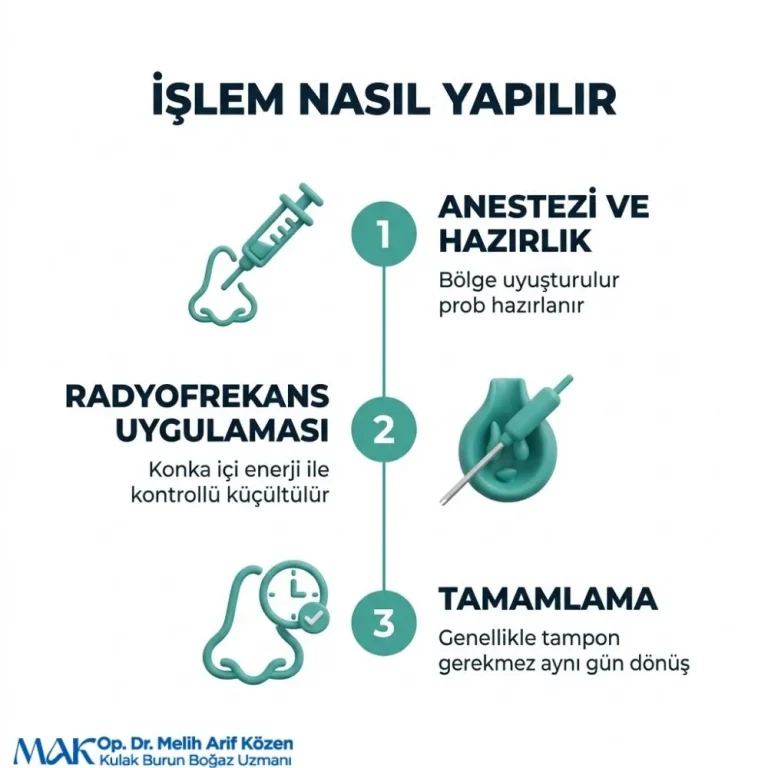 Alsancak Radyofrekans tedavisi sonrası iyileşme süreci ne kadar sürer