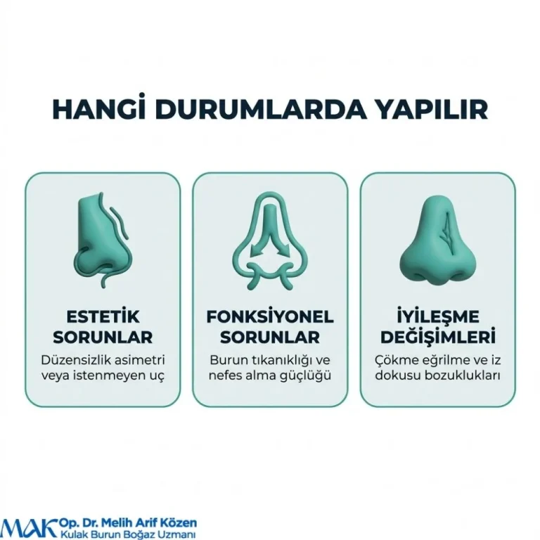 Alsancak Revizyon burun ameliyati olanlar Kadınlar Kulübü