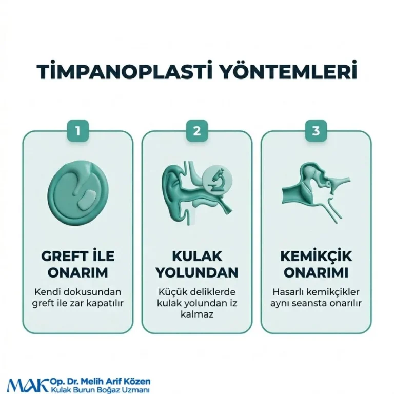 Alsancak Timpanoplasti ameliyatı nedir